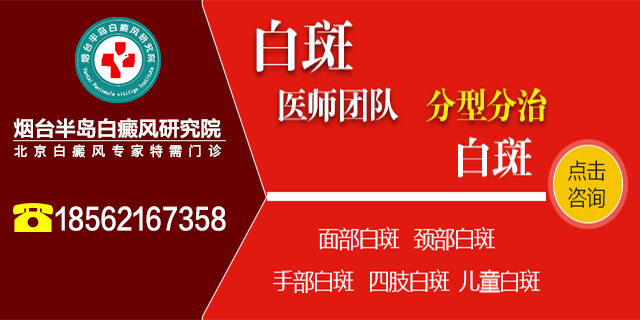 烟台白癜风医院