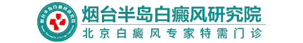 烟台白癜风医院